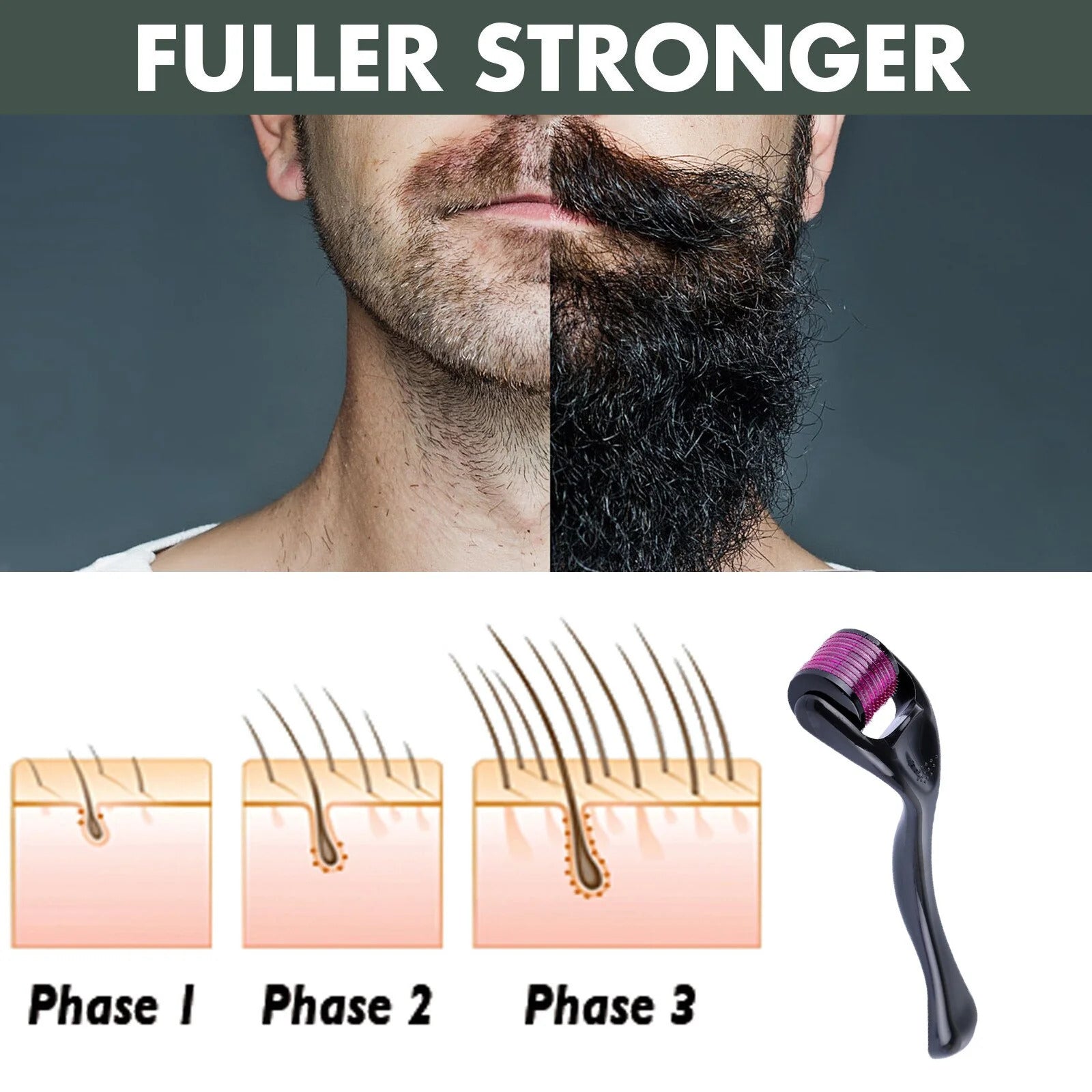 Derma Roller 0.5mm with 540 Titanium Needles